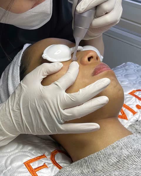 Tiêm
Filler
